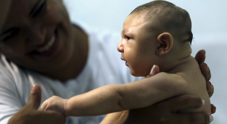 Governo veta pensão vitalícia para crianças com microcefalia causada pelo Zika vírus